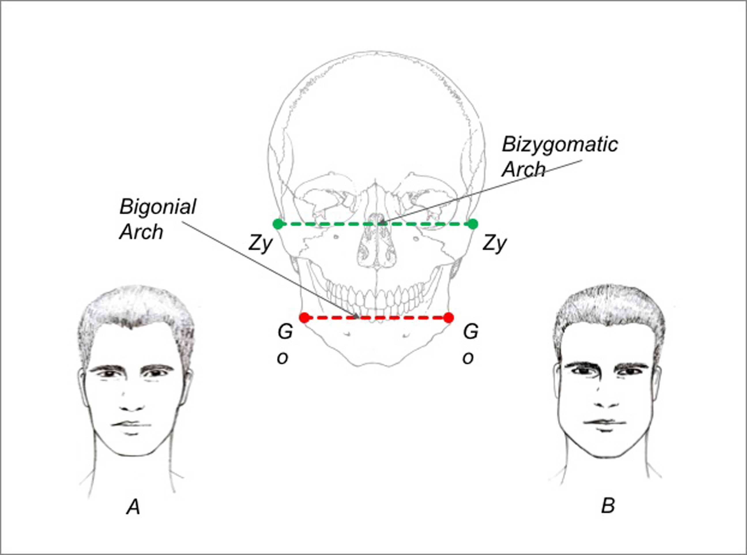 Замер какое лицо. Антропометрические точки лица в ортодонтии. Ширина лица. Высота и ширина лица. Измерение ширины лица по Изару.
